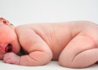 新生儿尿布皮炎是怎么引起的 新生儿尿布皮炎的治疗方法