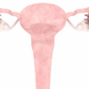 卵巢囊肿应该怎么办 卵巢囊肿的症状