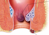 女性排便疼痛的原因 女性排便疼痛是因为痔疮吗