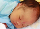 新生儿体质敏感应该怎么办