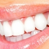 <b>牙结石是怎么形成的 牙齿牙结石是如何形成原因</b>