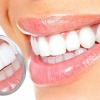 氟斑牙的原因 如何预防氟斑牙