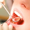 <b>牙龈出血是缺什么维生素</b>