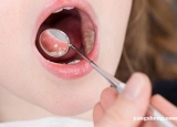 口腔溃疡为常见口腔疾病 口腔溃疡的痛苦