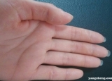 手指定期换皮是怎么回事 手指脱皮如何治疗