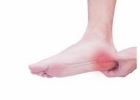 引发脚后跟疼痛原因有哪些？