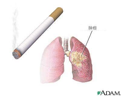 吸烟的危害 到底谁在为烟民的健康“买单”(3)