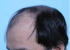 男人预防脱发的10个注意