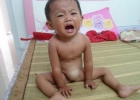 【图】脐疝是什么 婴幼儿为什么会有脐疝这种疾病
