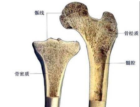 骨质疏松早期症状 骨骼变化是因缺钙所引起的
