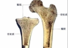 骨质疏松早期症状 骨骼变化是因缺钙所引起的