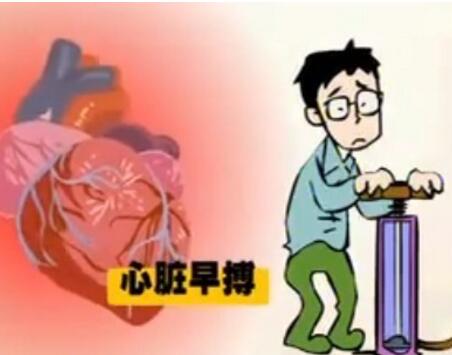 心脏保健常识 心脏早搏症状表现