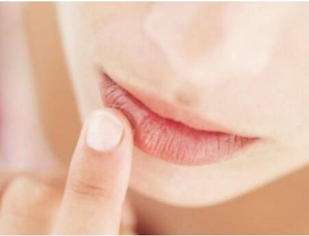 孕期护唇方法 是否可以使用唇膏？