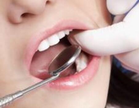 牙齿畸形 矫正牙齿方法有哪些？