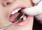 牙齿畸形 矫正牙齿方法有哪些？