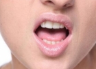 嘴角起泡原因 嘴角起泡怎么护理？