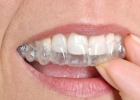 牙齿不好带牙套 那牙套需要带多久