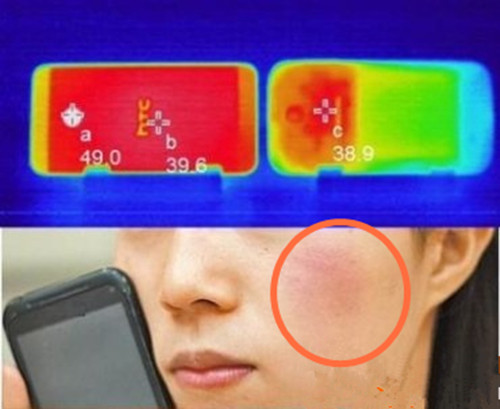 少女手机发热被烫伤怎么处理 手机发热能到多少度手机如何降温