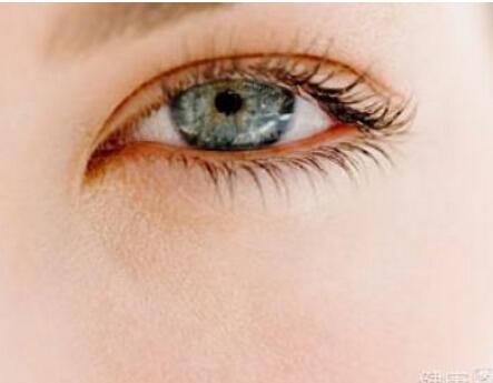 眼睑红肿原因 眼睑红肿的治疗方法