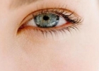 眼睑红肿原因 眼睑红肿的治疗方法