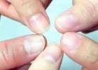 手指甲里没有月牙是疾病？