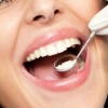 龋洞是什么 牙齿龋洞治疗