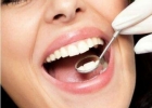 龋洞是什么 牙齿龋洞治疗