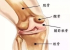 膝盖酸痛治疗方法 经常腿痛小心劳累