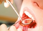 牙痛怎么办 7个小窍门帮男人快速止牙痛