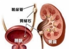 肾结石发病原因 身体变化证明患上肾结石