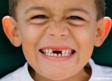 宝宝龋齿的危害有哪些?如何预防龋齿